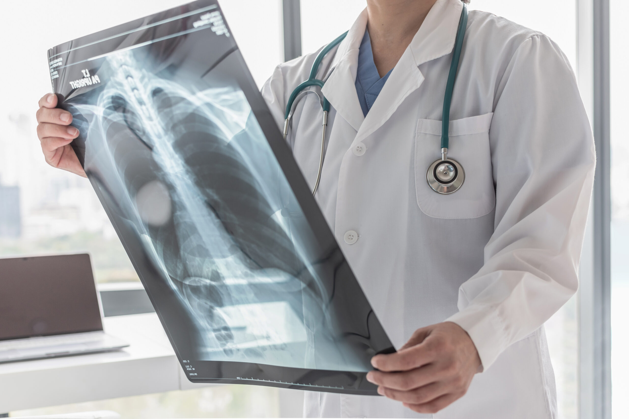 Everything You Need To Know About Cervical Herniated Disc Injuries